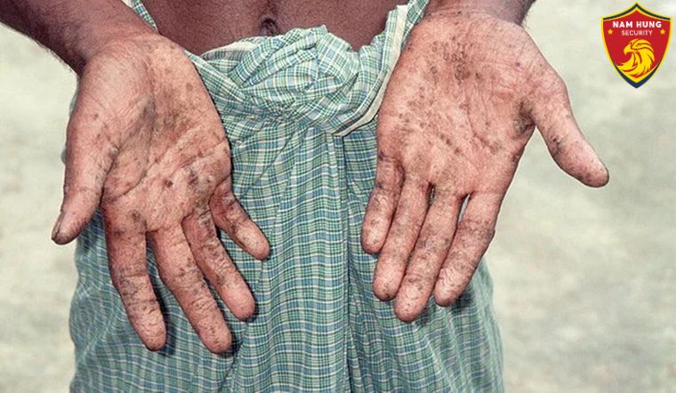 Cách Bảo Vệ Bản Thân Khỏi Nhiễm Độc Chì 1 Cách bảo vệ bản thân khỏi nhiễm độc chì